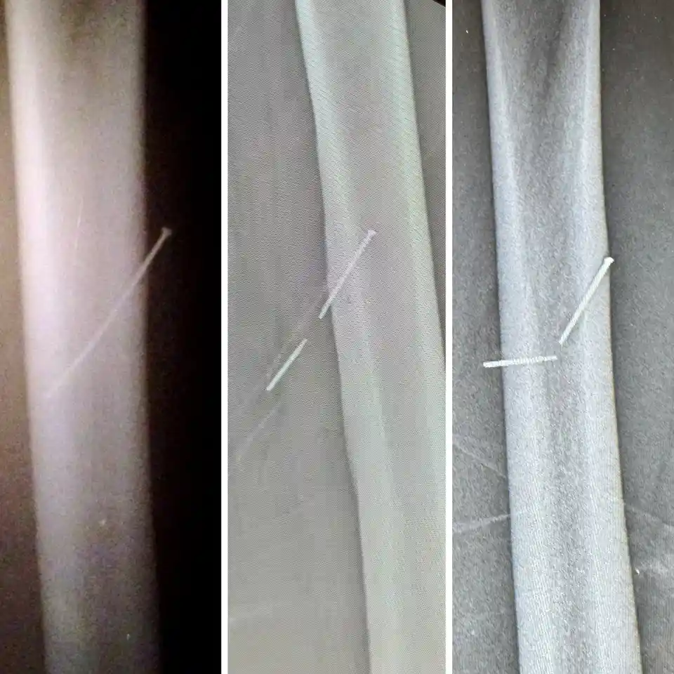 Injured by a Nail Gun in 2007: The Aftermath Revealed
