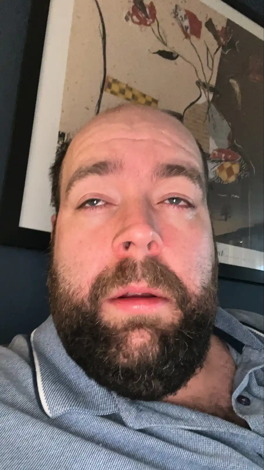 A close-up selfie of a man with a beard and receding hairline, wearing a blue collared shirt, looking directly at the camera…