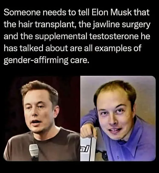 The image displays two side-by-side photos of Elon Musk: on the left, he appears in a public speaking setting with a…