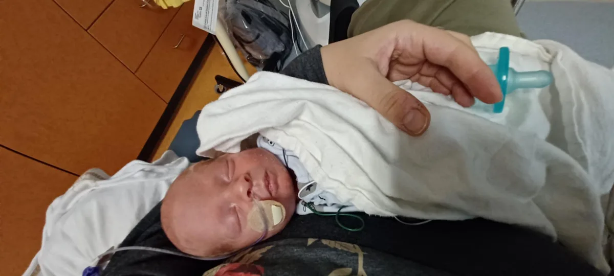 A newborn baby, wrapped in a white blanket and lying on an adult's chest, has medical equipment including a nasal cannula…
