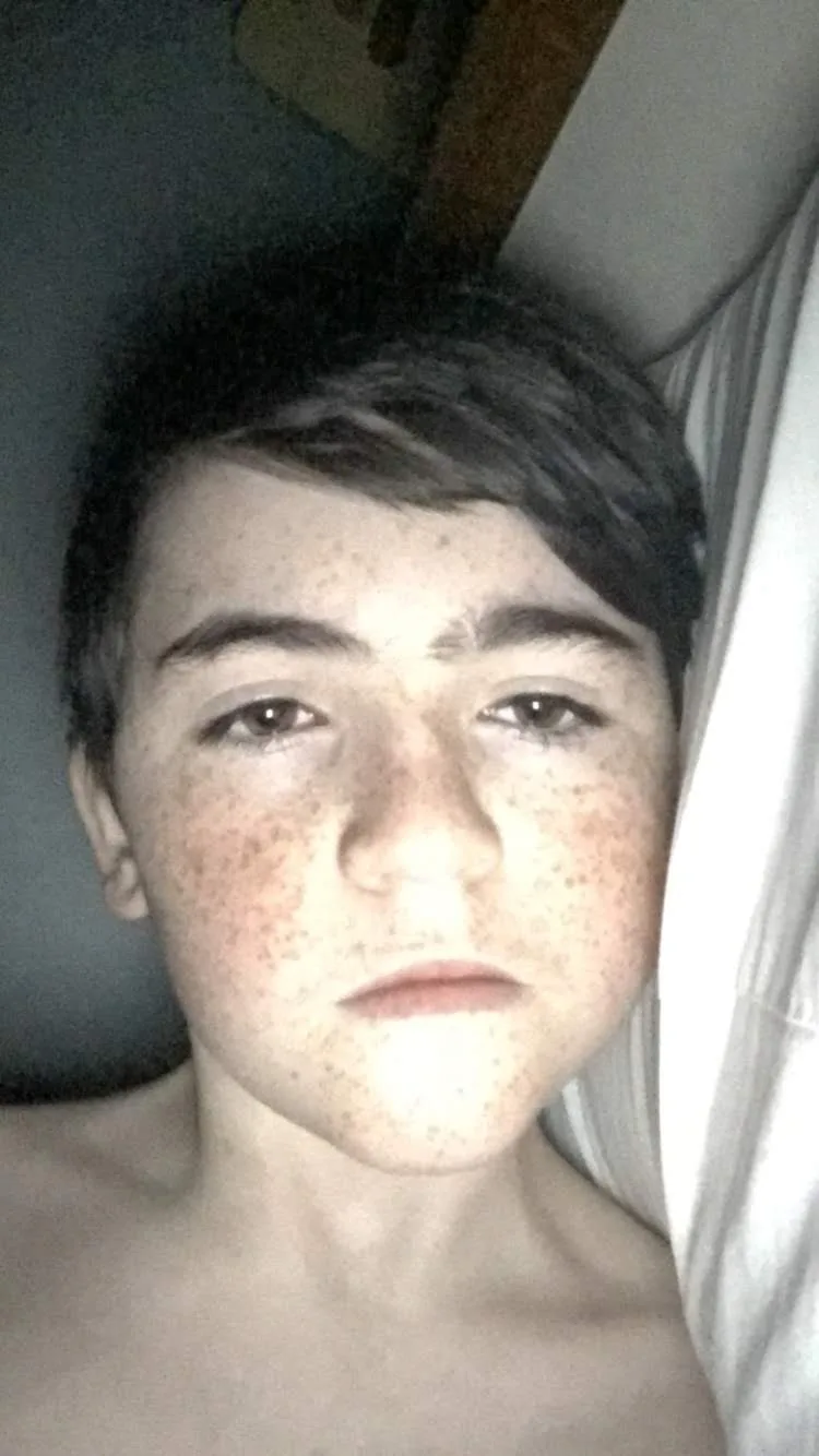 A close-up selfie of a young person with numerous freckles across their face and nose, looking directly at the camera with a…