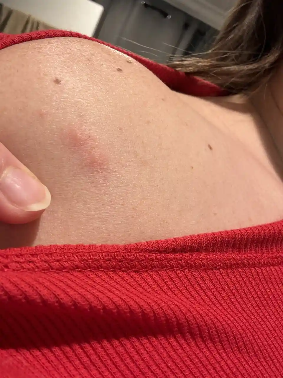 A close-up photo shows a person's shoulder and upper chest area, wearing a red ribbed top, with a visible reddish-purple…
