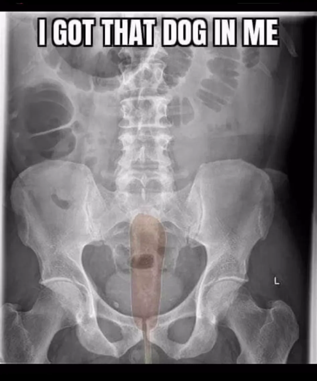 Memes recycled for your enjoyment: #44