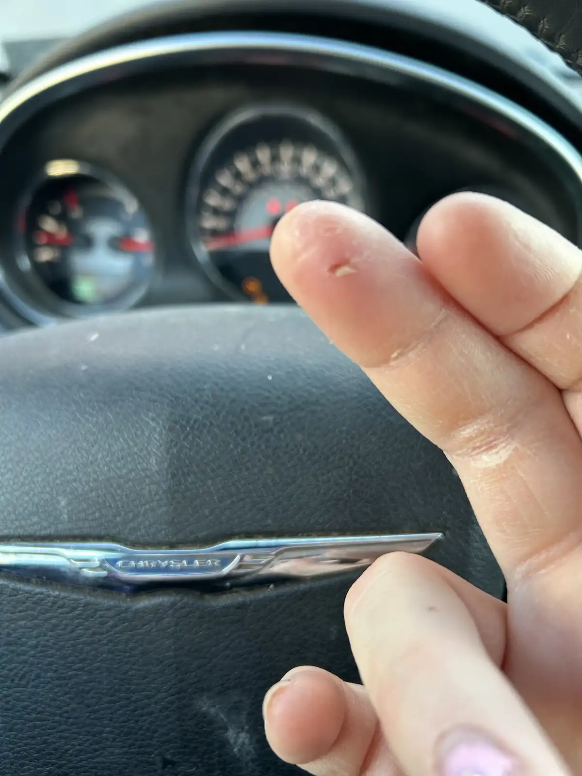 A close-up photo shows a person's hand holding up a finger with a small, fresh cut bleeding slightly, positioned in front of…