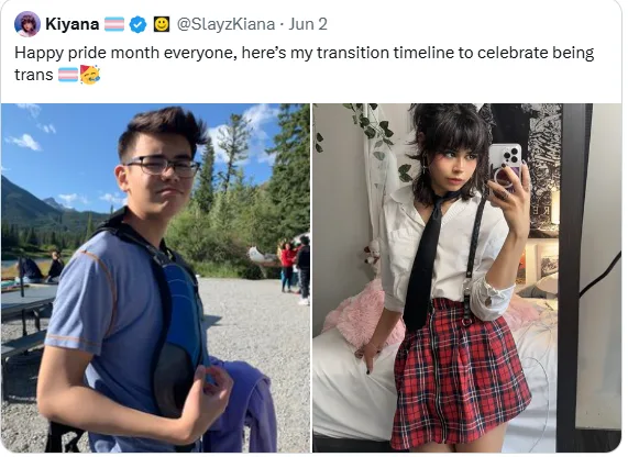 A side-by-side image shows a young person in a blue shirt and glasses outdoors, then the same person in a white shirt, black…