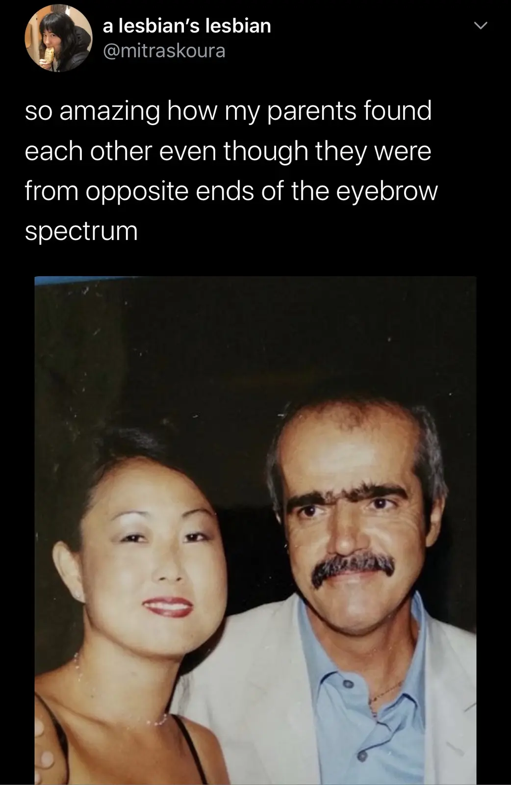 A vintage photo shows a smiling woman with very sparse or nonexistent eyebrows standing next to a man with thick, bushy…