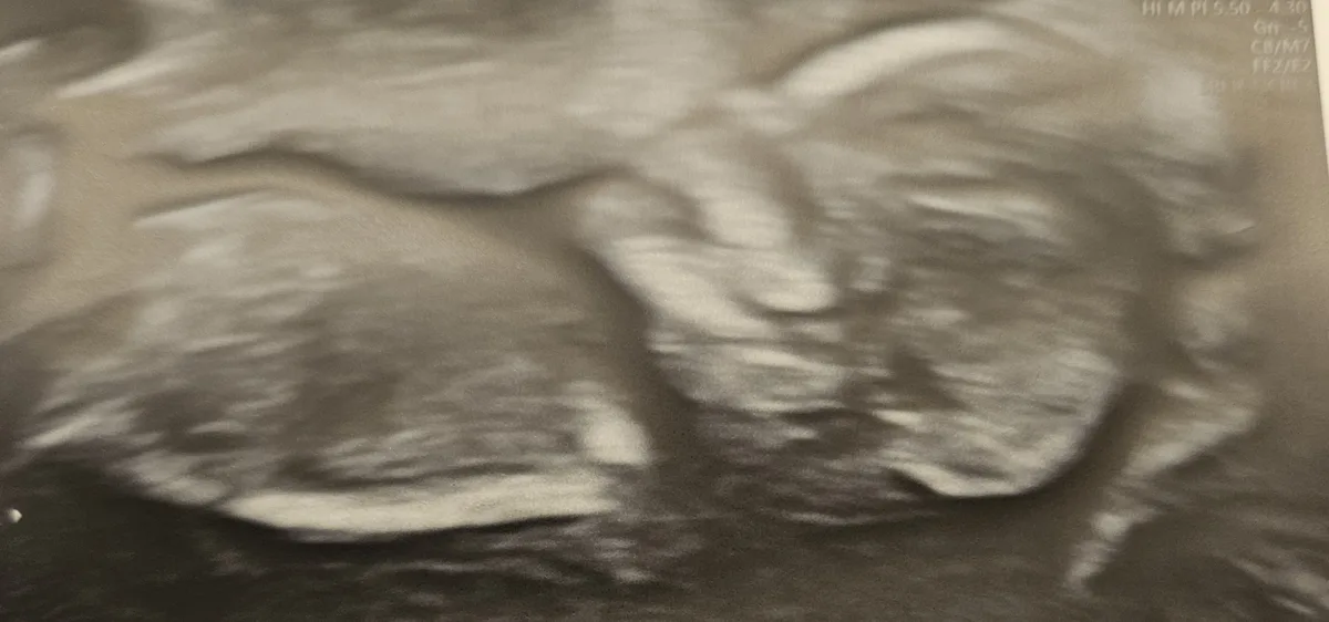 A Little Early, But Here's My In-Utero Selfie!