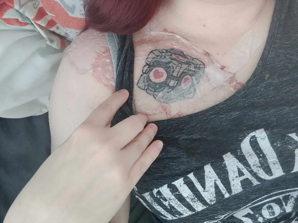 A person with red hair is shown with a fresh tattoo of a mechanical heart on their chest, covered in plastic wrap and…
