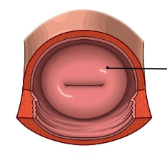 a medical-style diagram showing the inside of a vagina with a small horizontal line drawn across the center and a pointer…