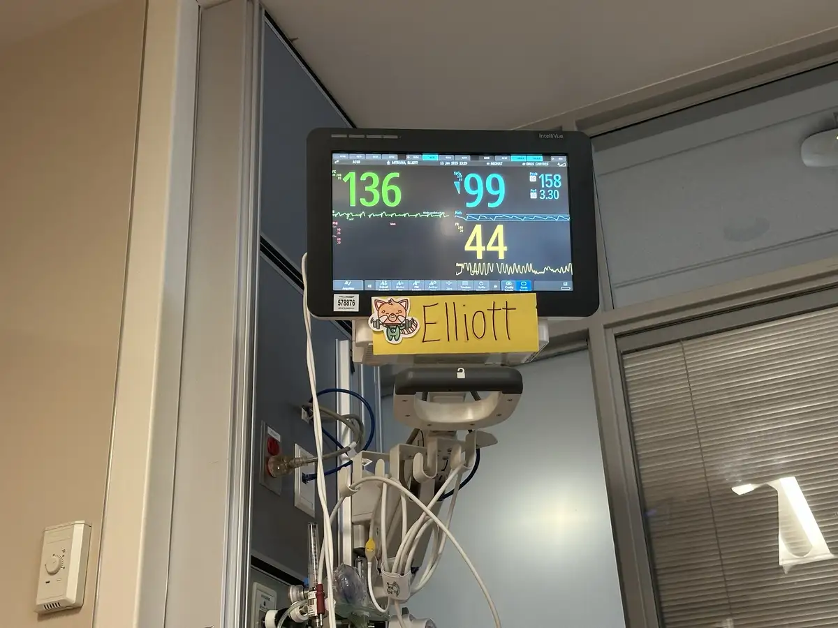 A hospital patient monitor displays vital signs including a heart rate of 136, oxygen saturation of 99, and a temperature of…