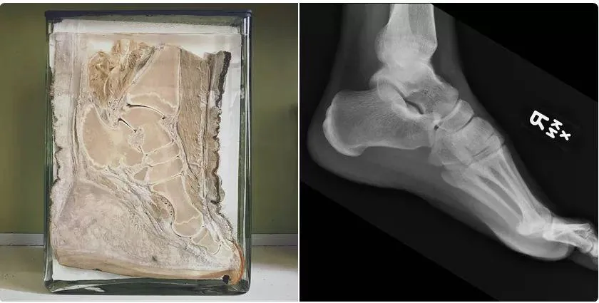 A Size Comparison: Elephant Foot vs. Human Foot