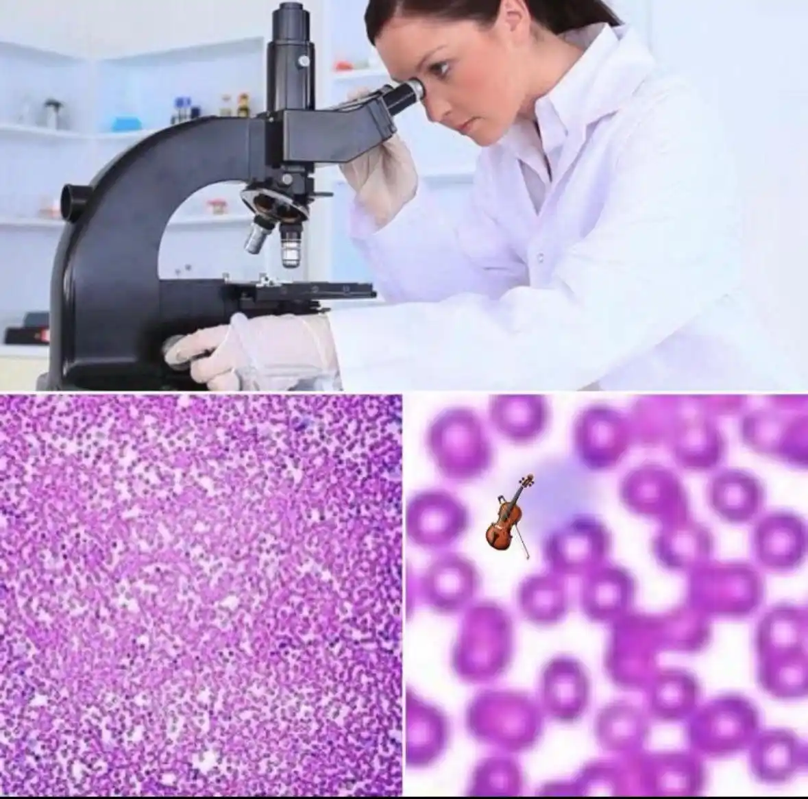 A woman in a lab coat and gloves peers into a microscope in a lab. Below, two microscope images show purple-stained cells…