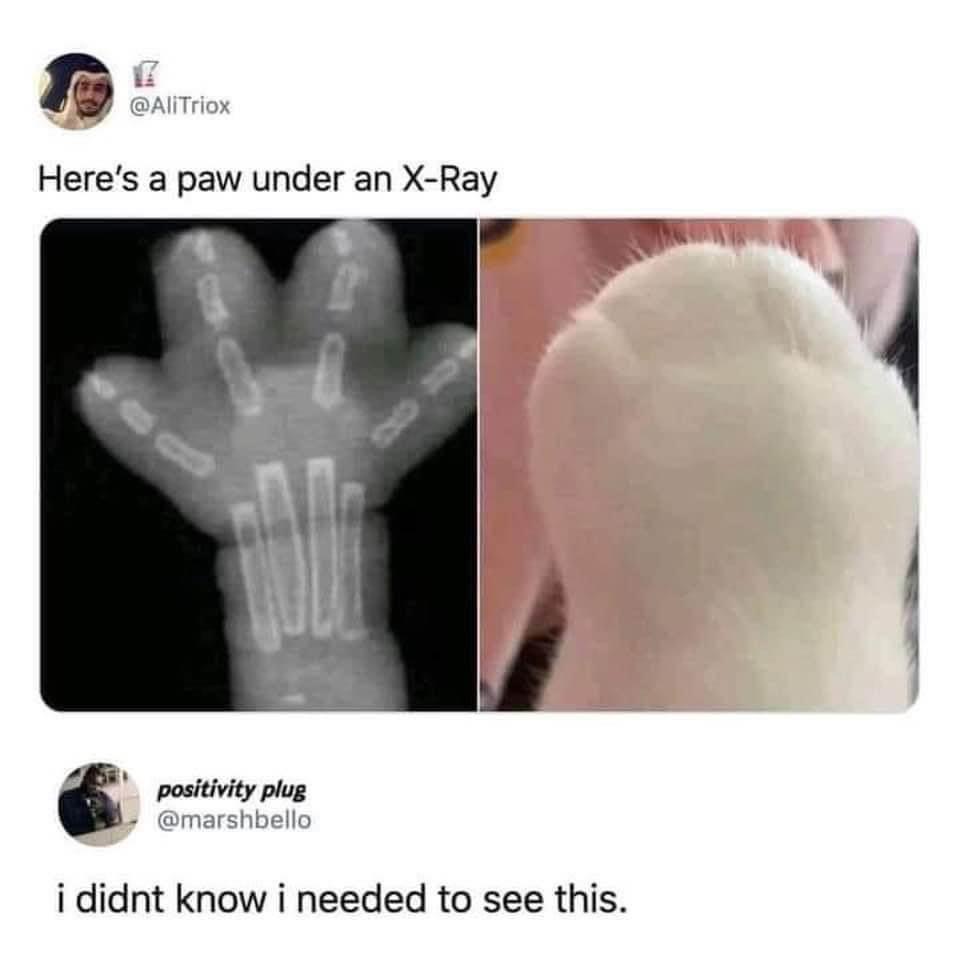 The image displays a side-by-side comparison: on the left, an X-ray of a human hand showing bones, and on the right, a…