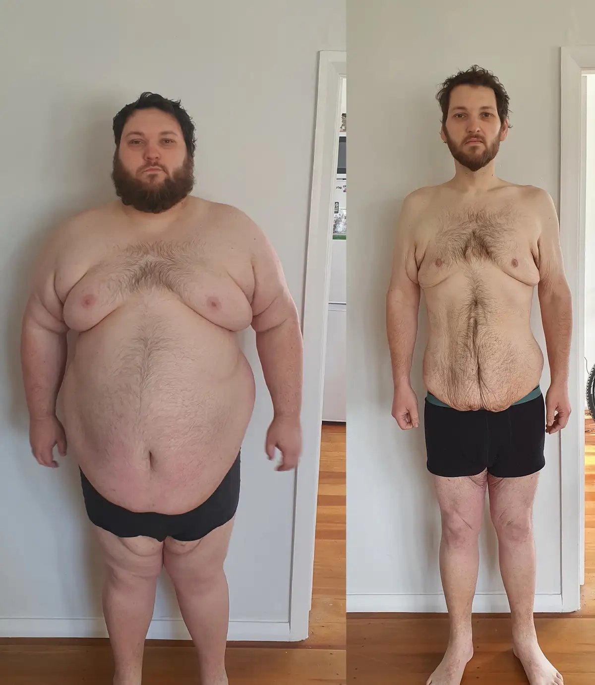 Achieved a Remarkable 100 kg Weight Loss in Just One Year!