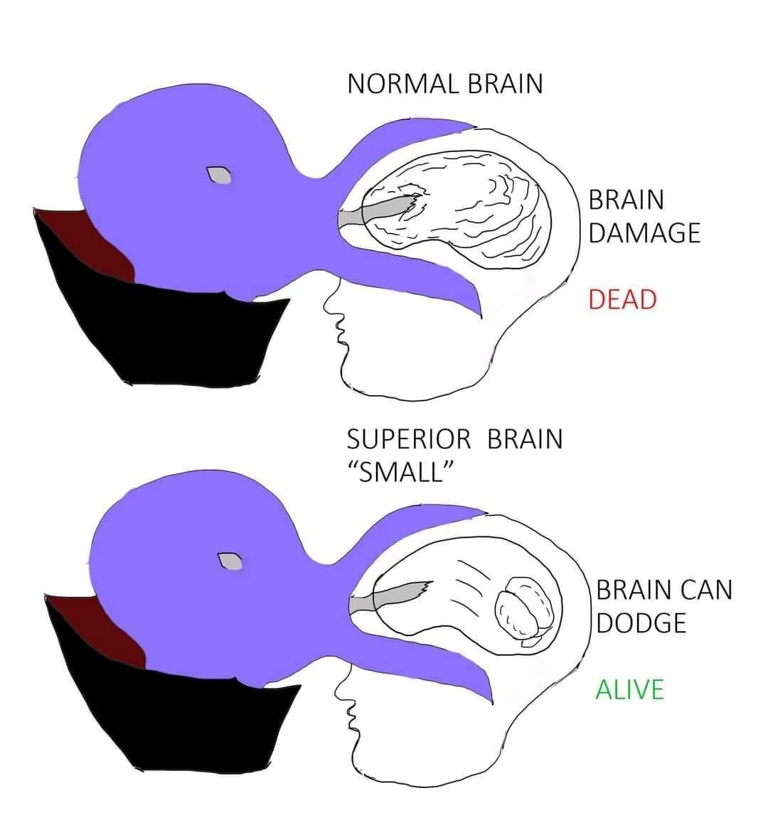 The image displays two side-by-side diagrams of human heads with brains. The top diagram, labeled 'NORMAL BRAIN', shows a…