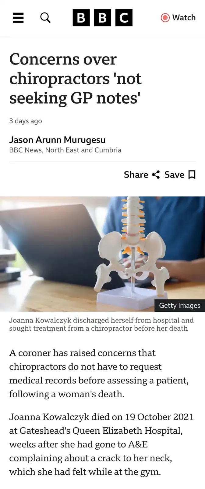 A BBC News article screenshot about chiropractor concerns, featuring a photo of a spine model on a desk with a laptop. The…