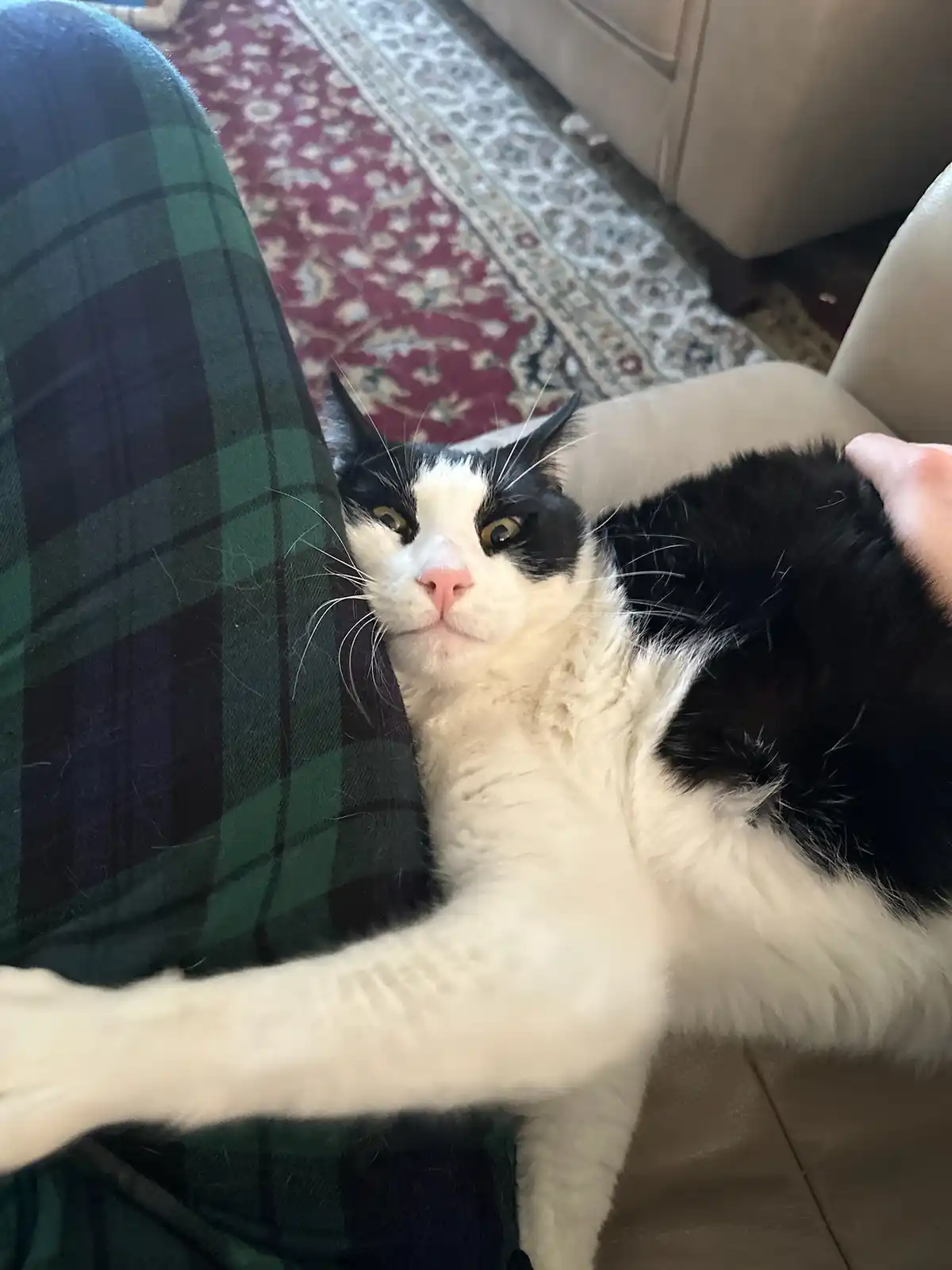A black and white cat with wide, unimpressed eyes lies on a person's lap, looking directly at the camera while being petted…