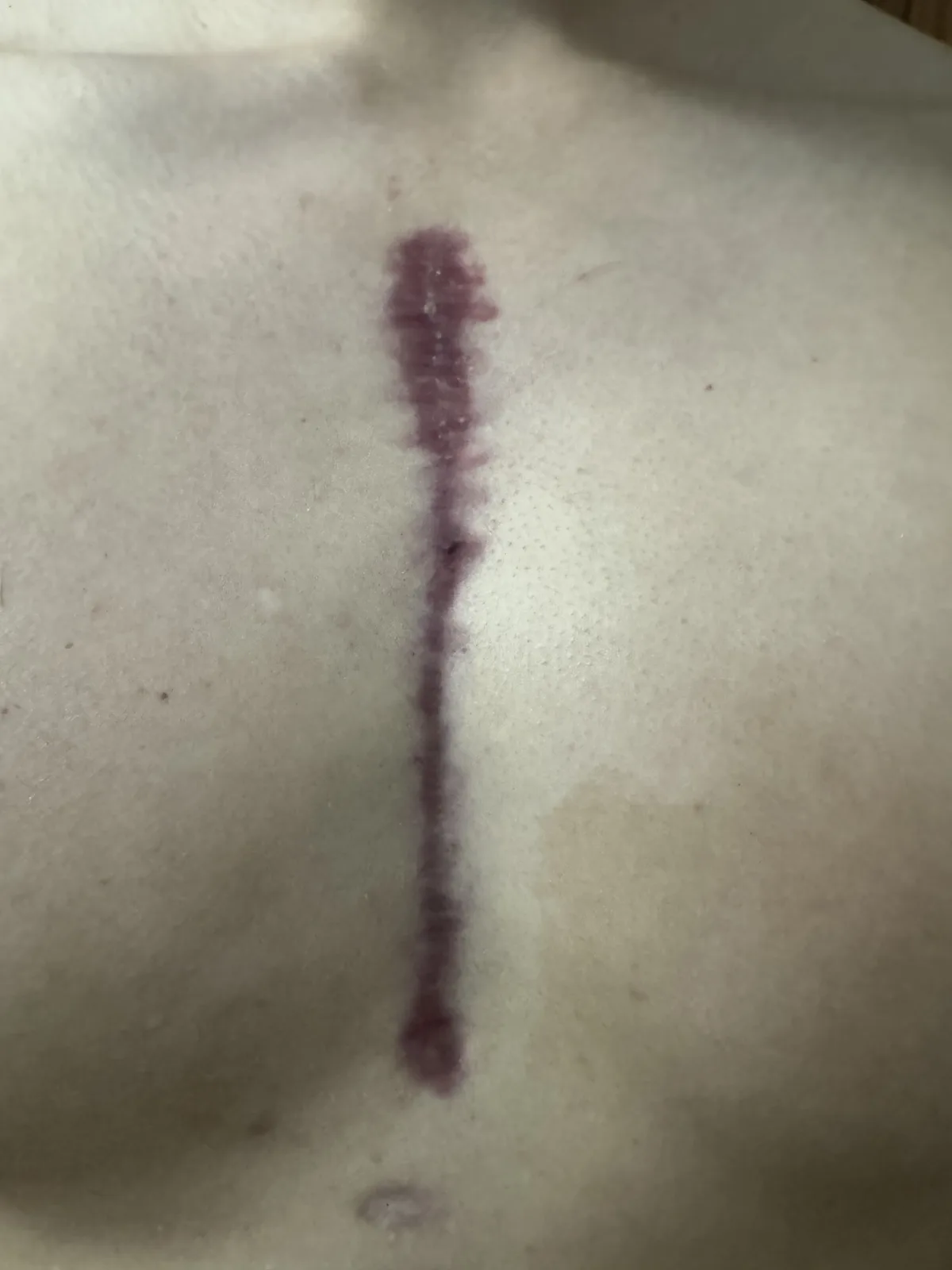 Heartache: The Wound That Just Won't Heal