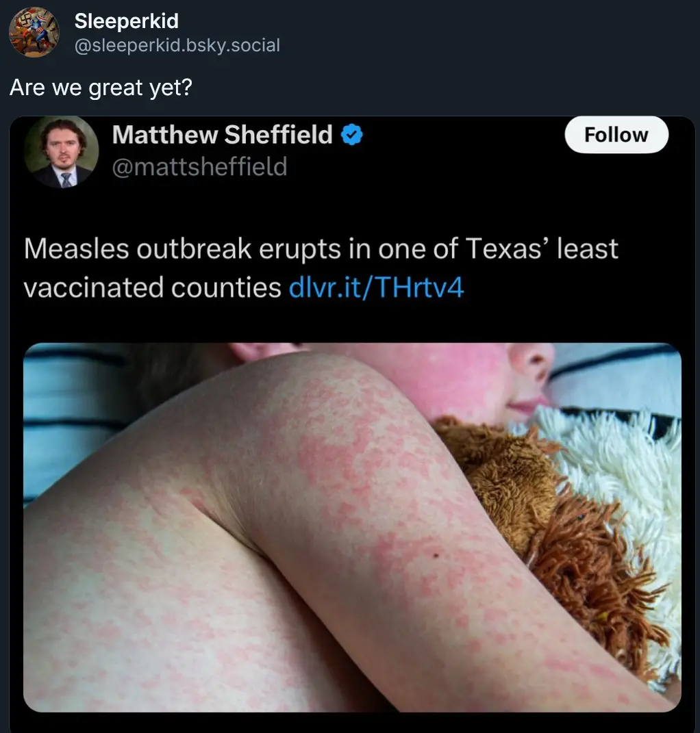 A screenshot of a social media post by Matthew Sheffield shows a close-up photo of a child's arm and shoulder covered in red…