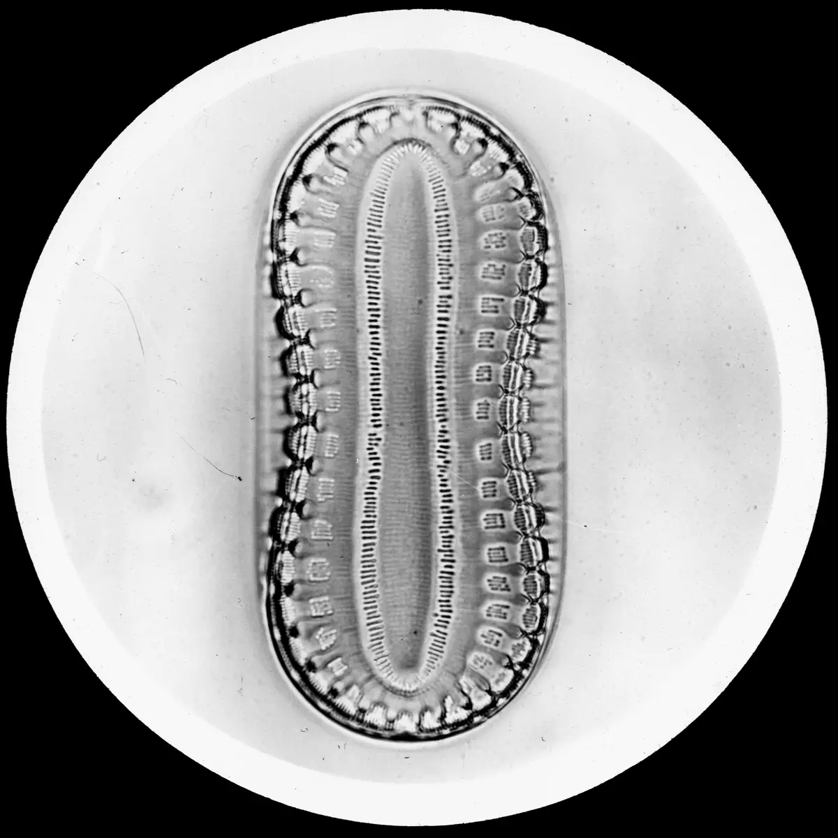 A black-and-white microscopic image shows a detailed, oval-shaped organism with intricate, repeating patterns along its…