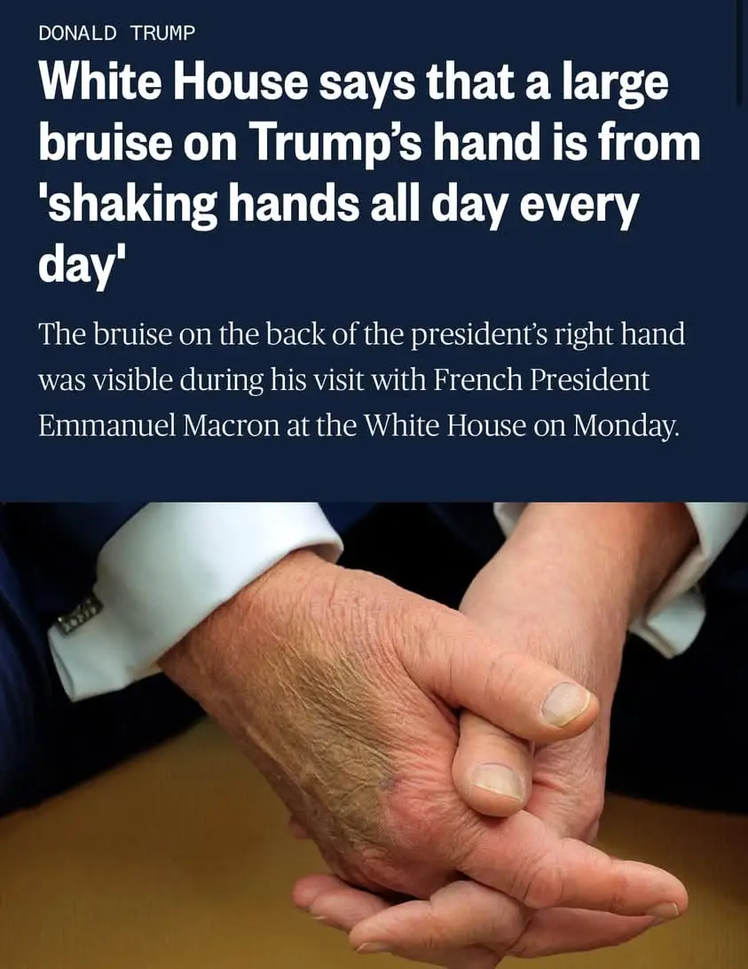 Injury Report: Local 78-Year-Old Businessman Hurt While Shaking Hands