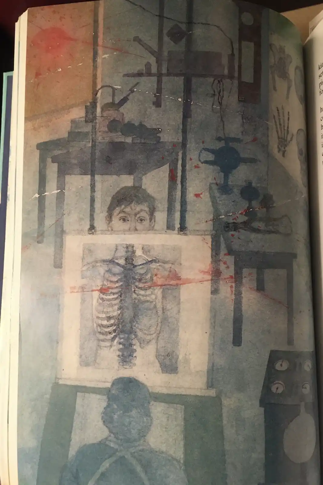 A watercolor illustration from a book depicts a surreal medical scene with a child's face peering over a skeletal torso…