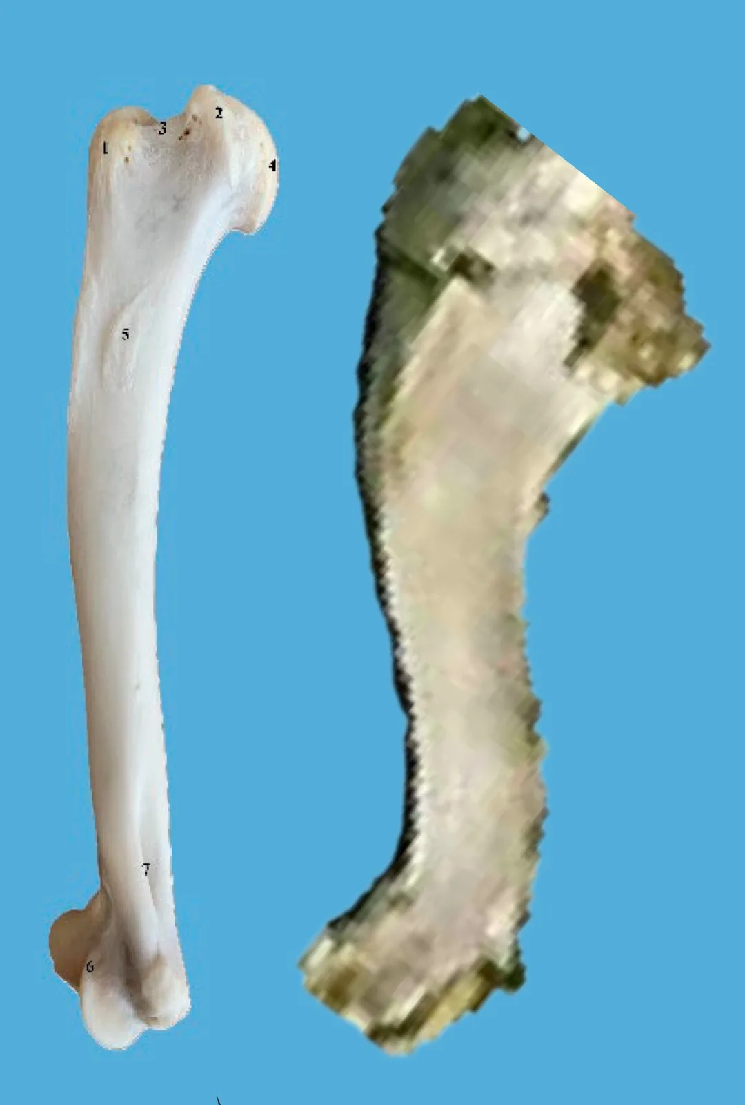 The image displays two bones side by side against a blue background. The left bone is clear and anatomically labeled with…