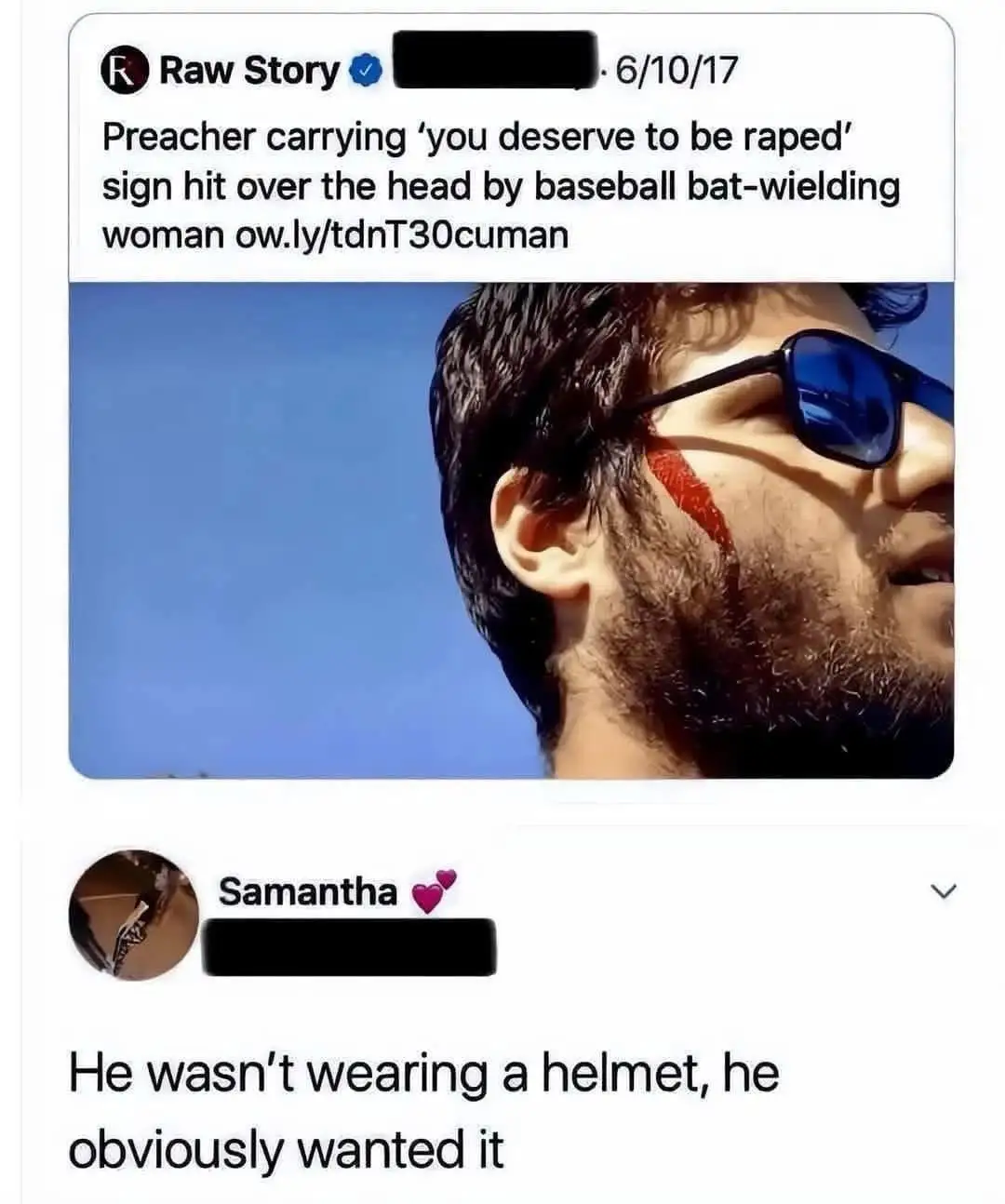 A screenshot of a social media post shows a man with a beard and sunglasses, sporting a red gash on his cheek, implying he…