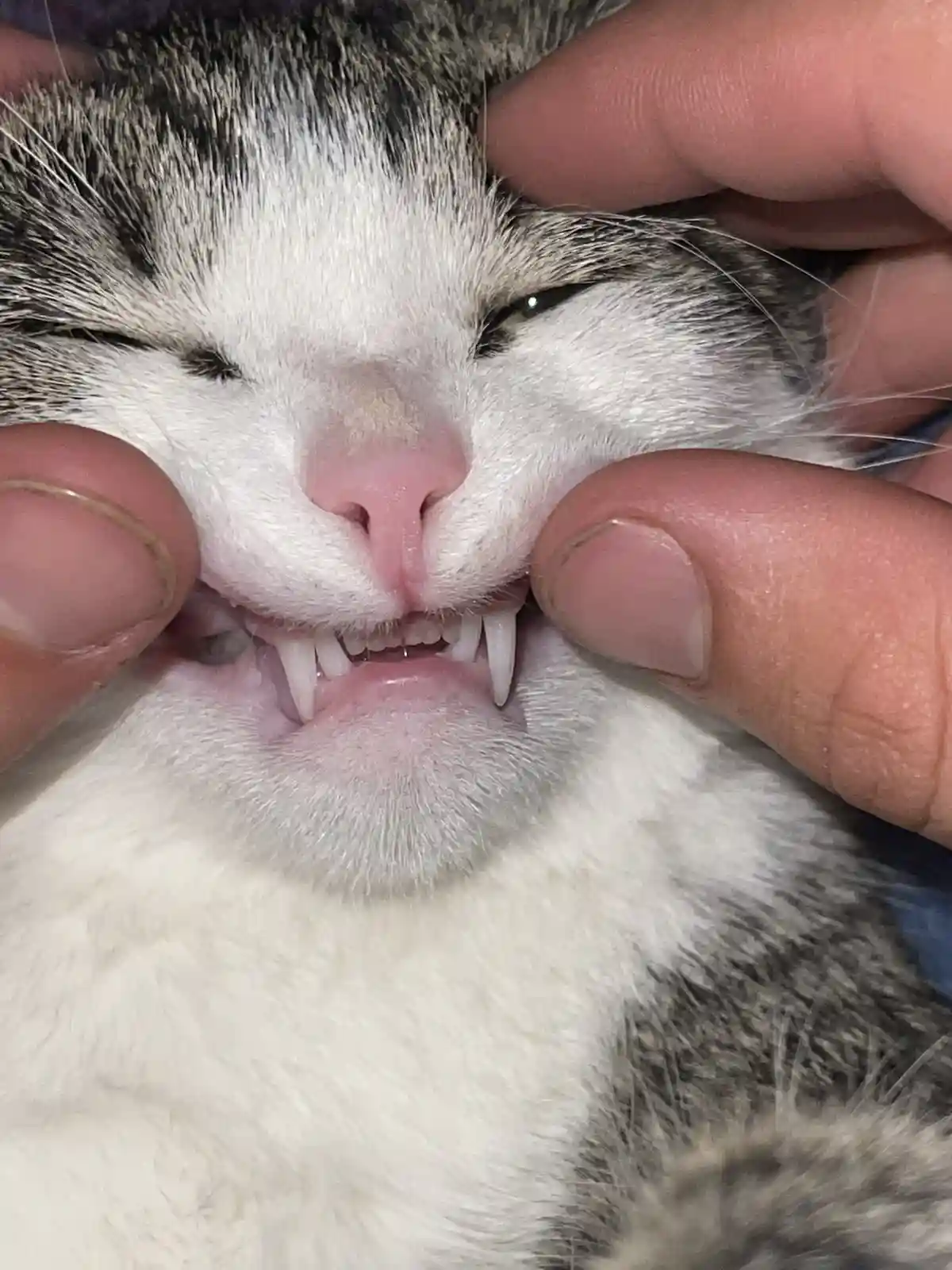 A close-up photo shows a person's fingers gently pulling back the lower lip of a white and gray tabby cat, revealing its…