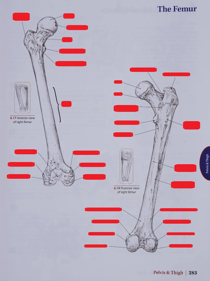 Anatomical textbook page showing anterior and posterior views of the femur bone with all labels redacted by red rectangles…