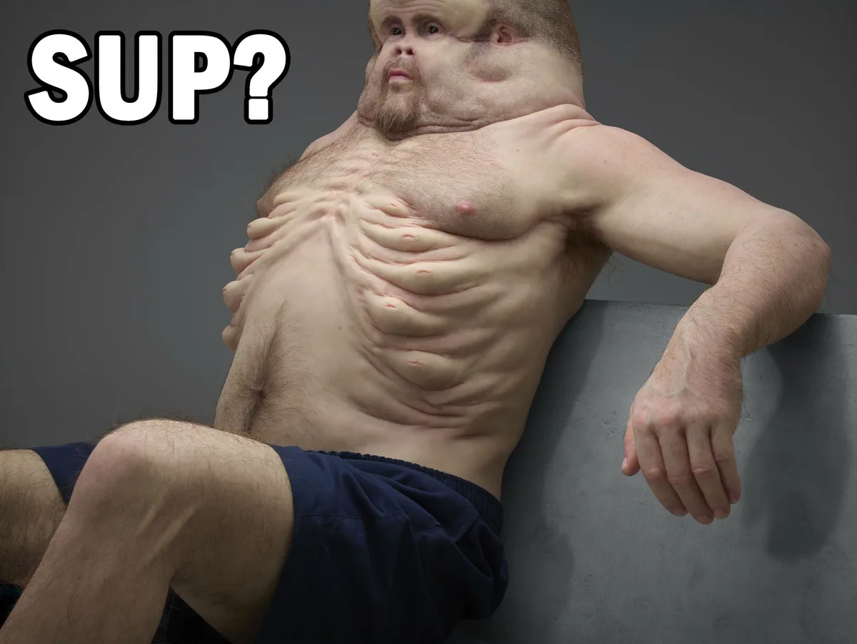 A shirtless man with a severely distorted, swollen face and torso, sitting on a gray surface, looks directly at the viewer…
