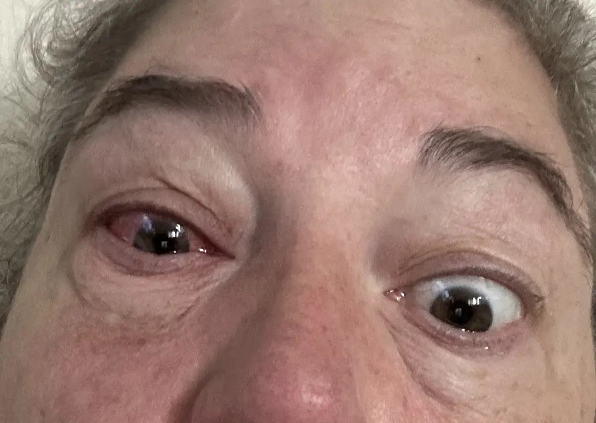 Can you hit the eye and turn it red?