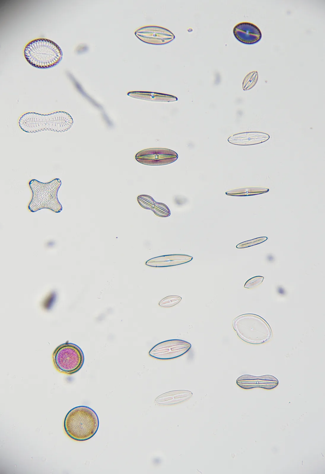 Not the Best Photos, But Check Out These Awesome Diatoms!