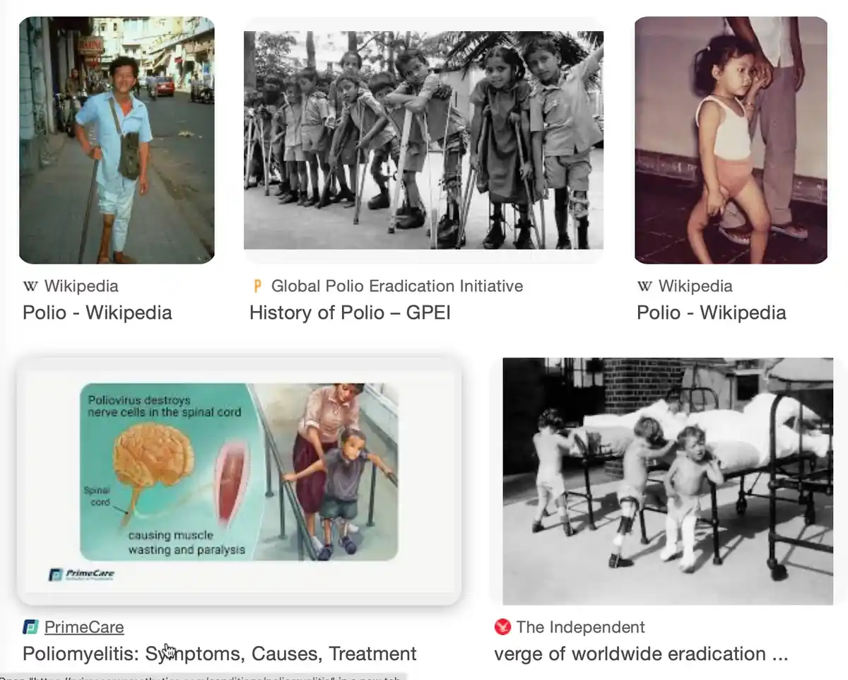 Let's Bring Back Polio! (Just Kidding)