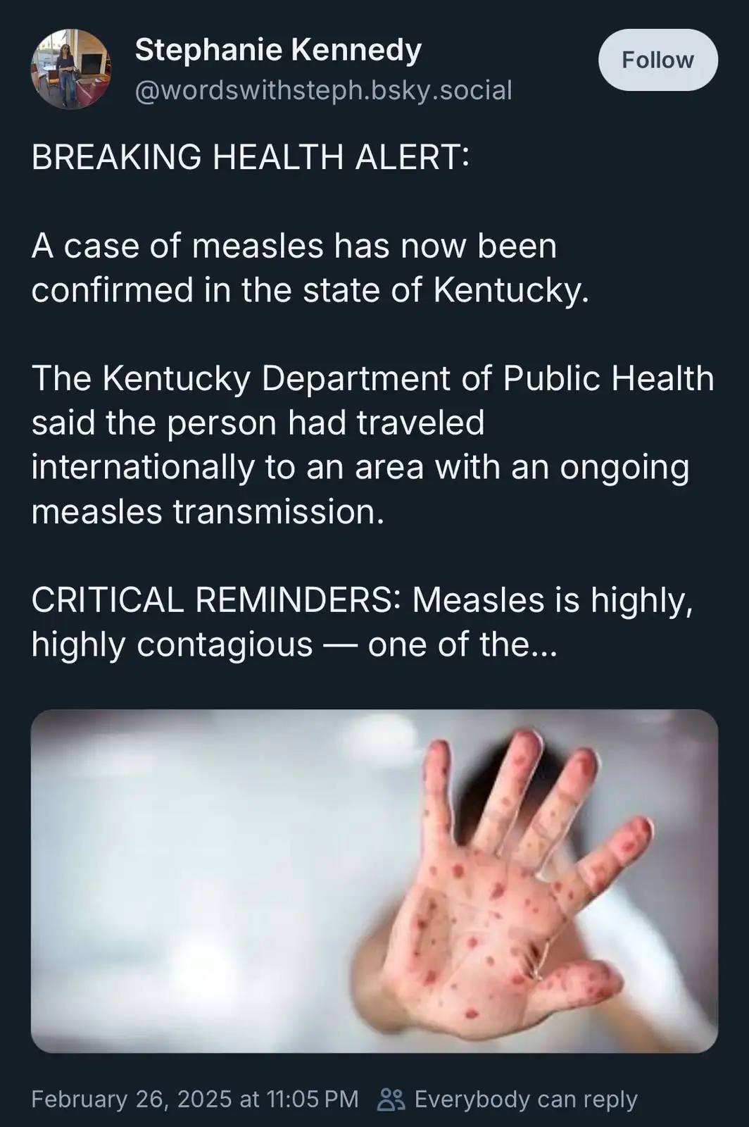 A screenshot of a social media post styled as a breaking health alert, featuring text about a measles case in Kentucky and a…
