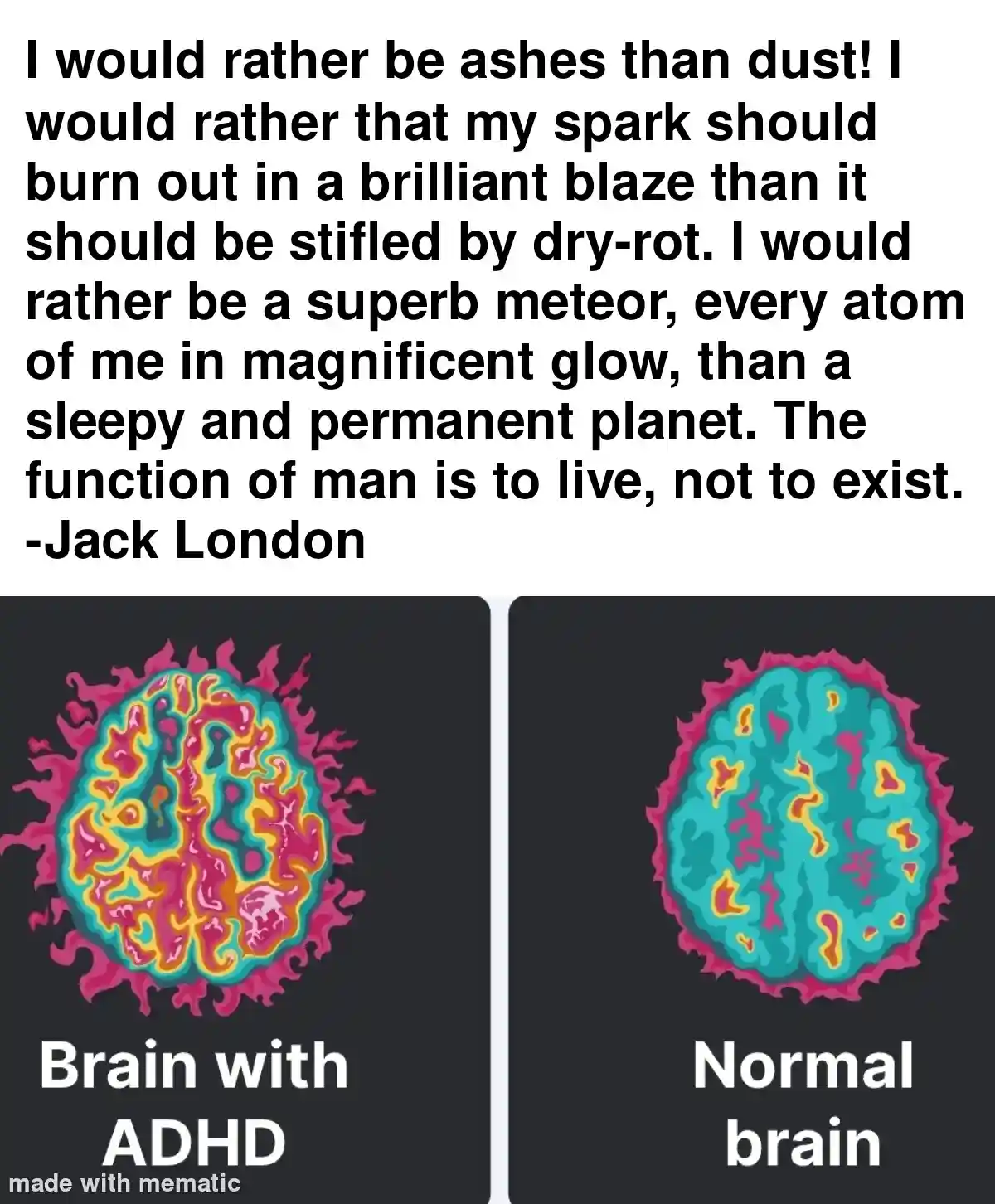 The image displays a split-screen comparison of two stylized brain illustrations. The left side shows a brain labeled 'Brain…