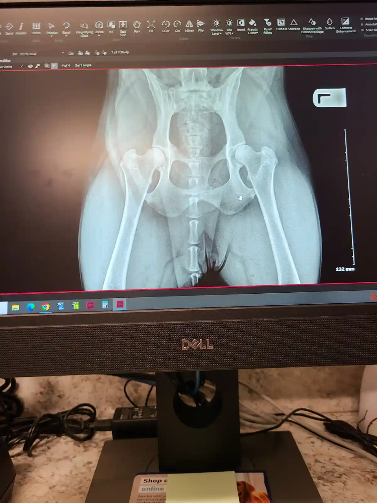 A computer monitor displays a medical X-ray image of a human pelvis and upper legs, with the cursor hovering near the hip…