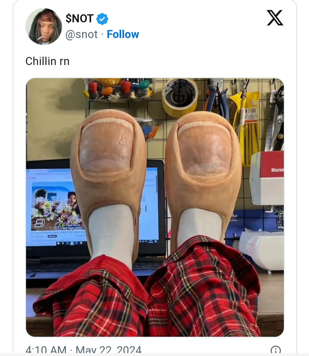 A person wearing red plaid pajamas and white socks has their feet in oversized, tan, clog-style shoes with exaggerated…