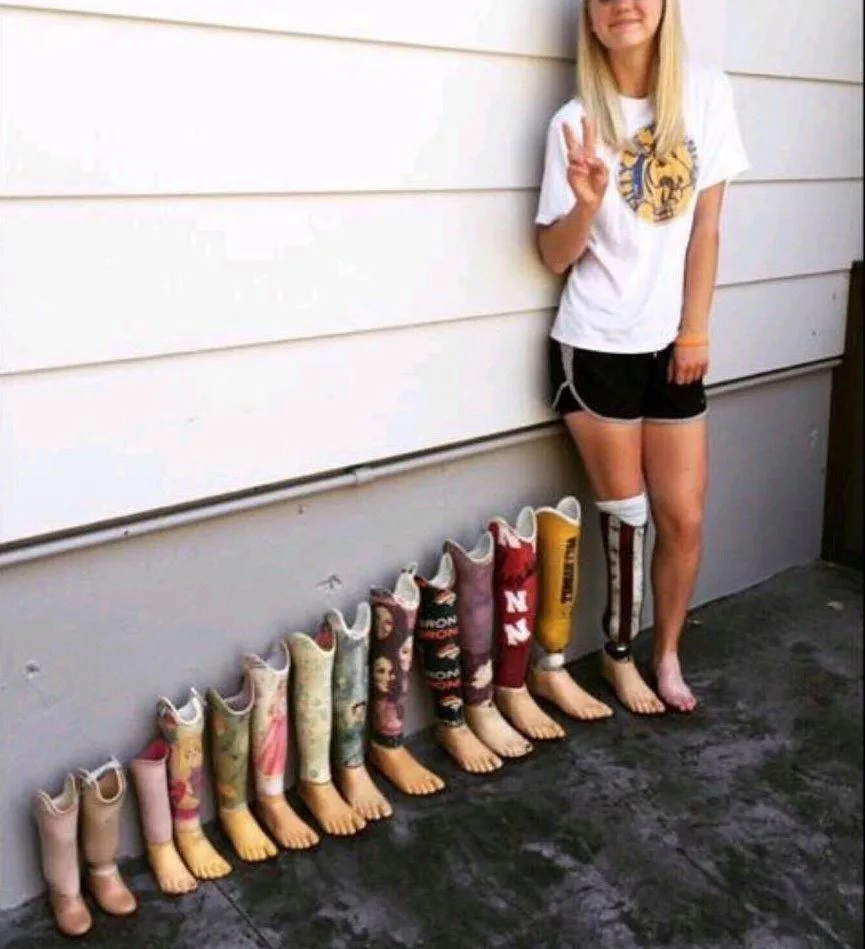A young woman with a prosthetic leg stands barefoot next to a row of colorful, decorated prosthetic legs lined up on the…