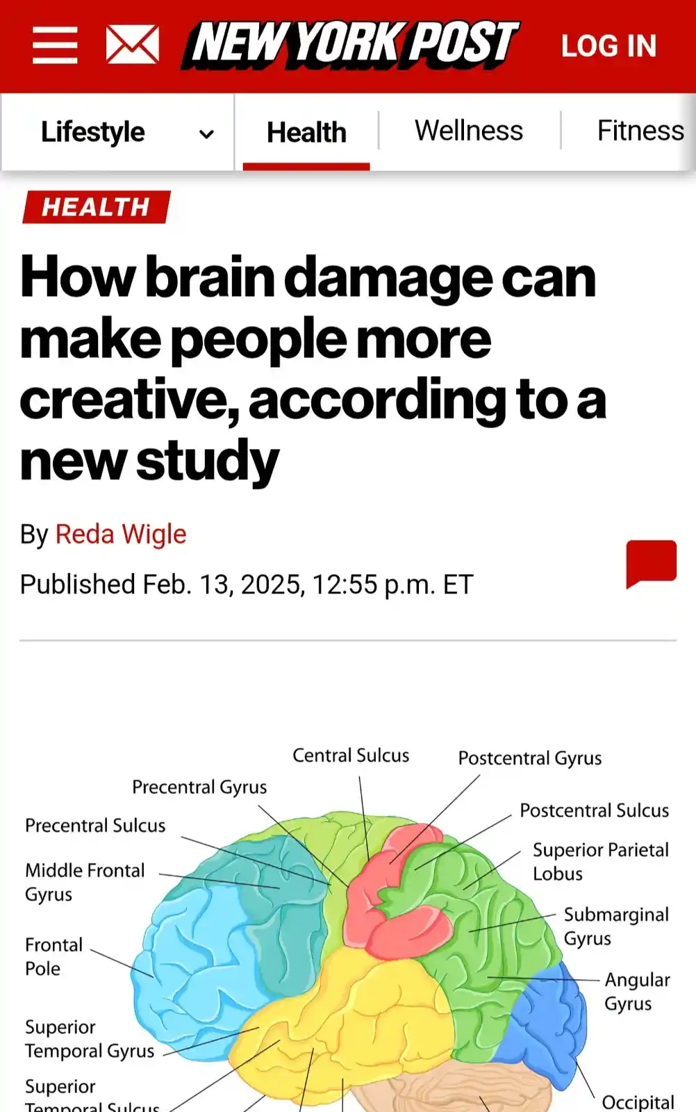 A screenshot of a New York Post article titled 'How brain damage can make people more creative, according to a new study' by…
