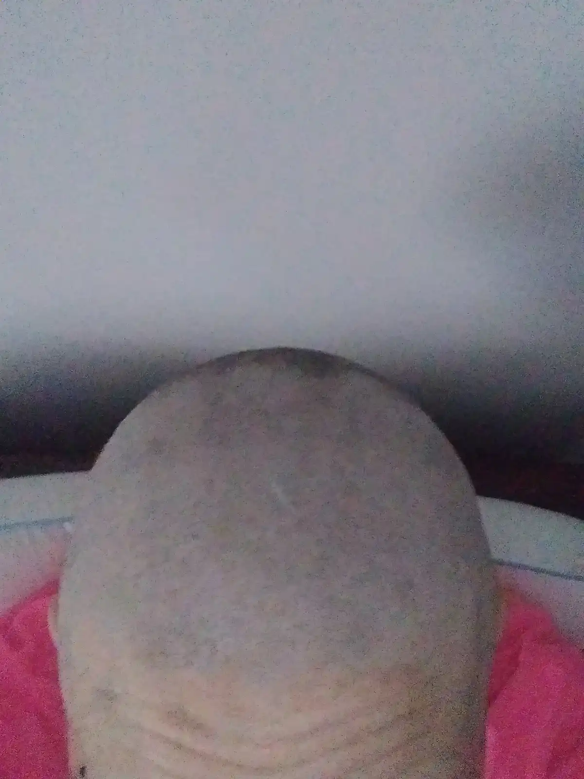 A blurry, low-resolution photo shows the top of a person's head with very little visible hair, wearing a pink shirt. The…
