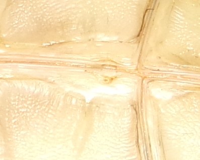 A close-up image shows the textured, translucent surface of what appears to be a plastic or glass container, possibly a food…
